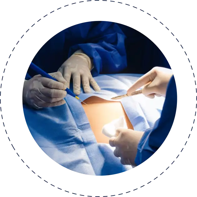 General Surgery Department in Jaipur