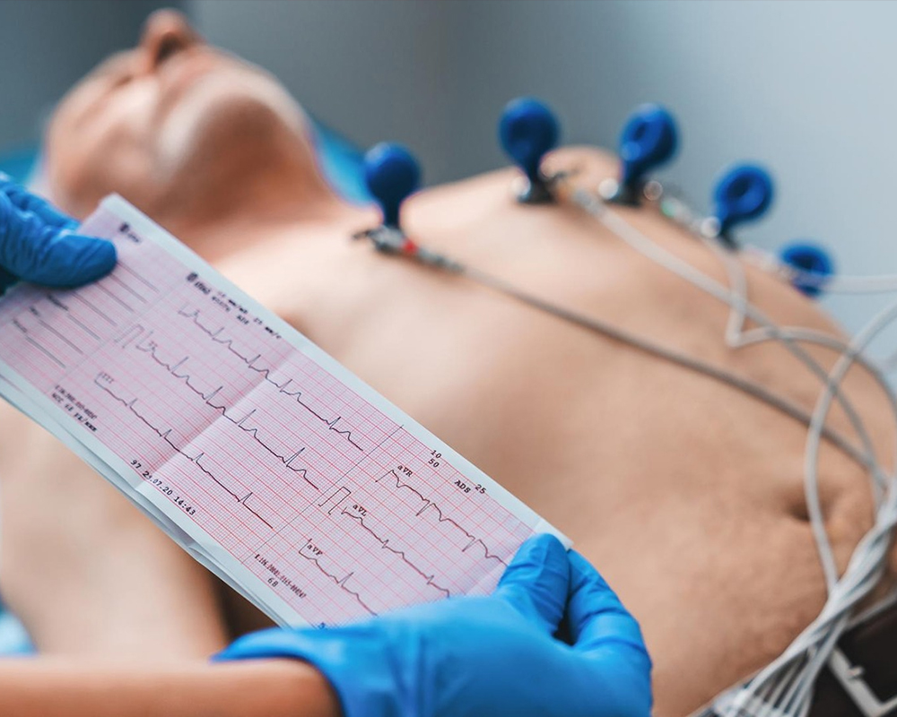 ECG Test Price